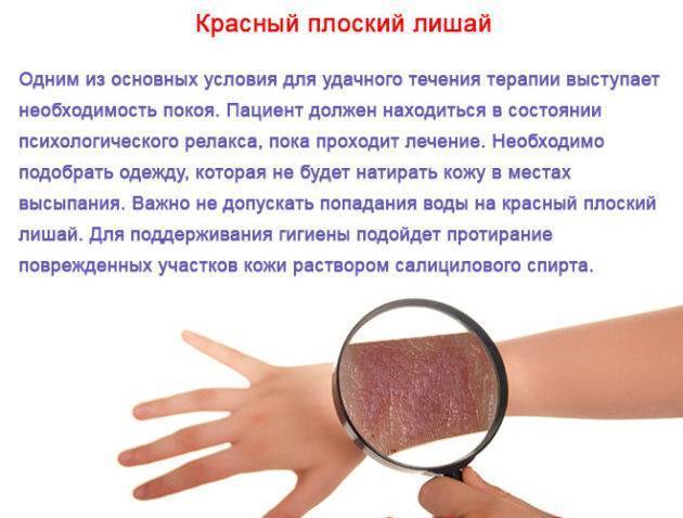 Виды сыпи: петехиальная, папулезная, эритематозная, при сифилисе
