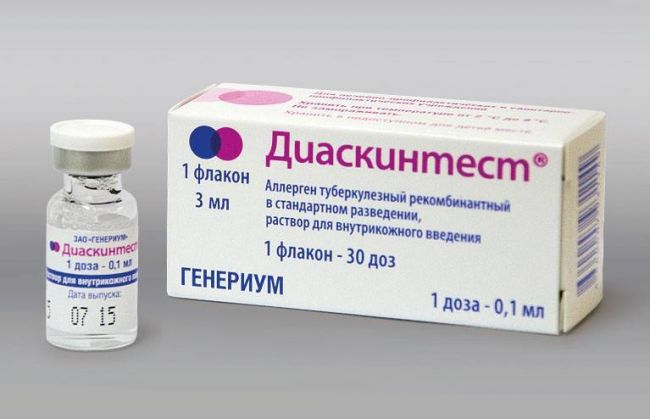 Какой должна быть норма реакции манту у детей в 4 года?