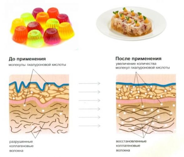 Диета при остеоартрозе коленного сустава