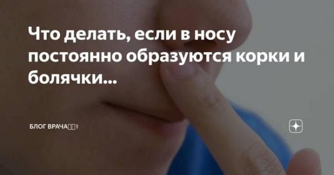 Простуда в носу: чем лечить в домашних условиях быстро