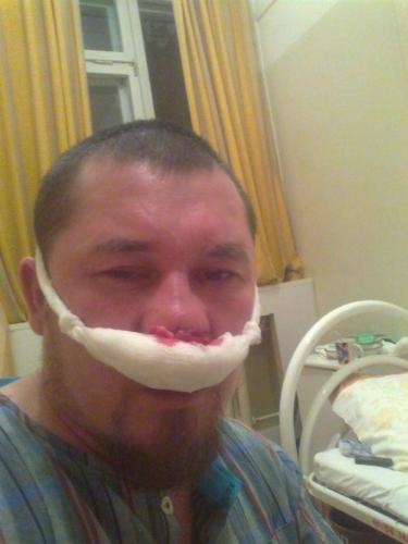 Как отсосать сопли у ребенка