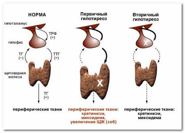 Тиреотропный гормон (ТТГ)
