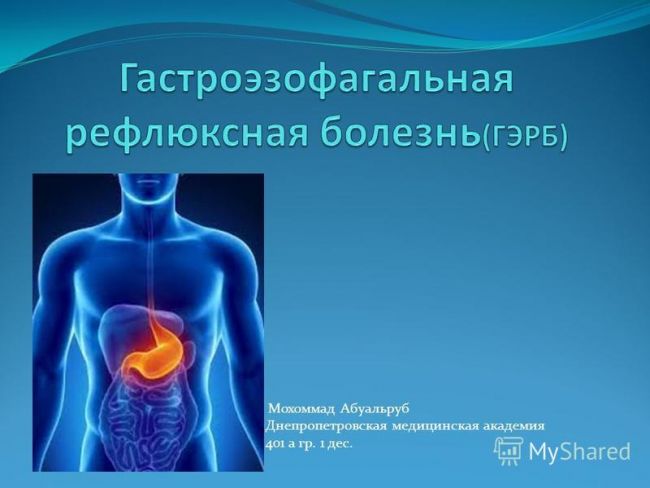 Гастроэзофагеальная рефлюксная болезнь (гэрб)