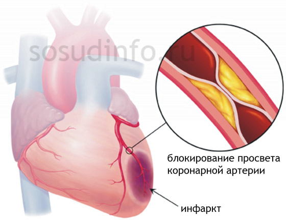 причины, признаки, симптомы и лечение