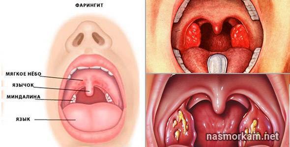 Что щекочет в горле и вызывает кашель и зуд?