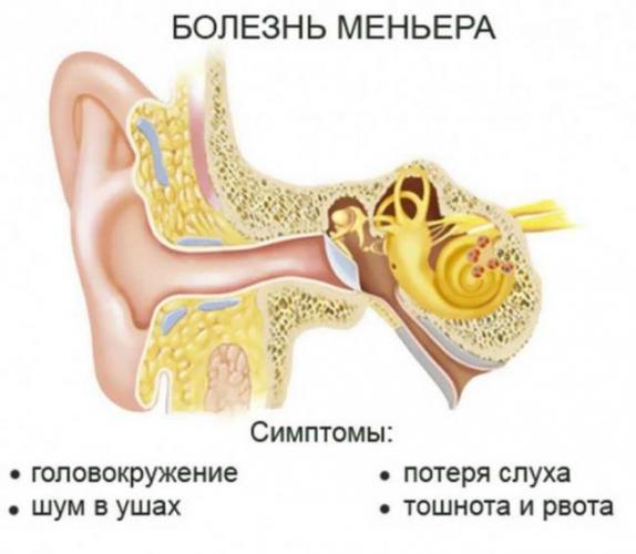 Болит горло закладывает уши без температуры