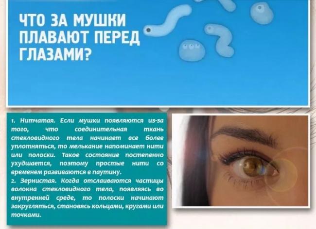 Что такое деструкция стекловидного тела и как лечить?