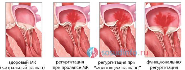 Клиническая эхокардиография