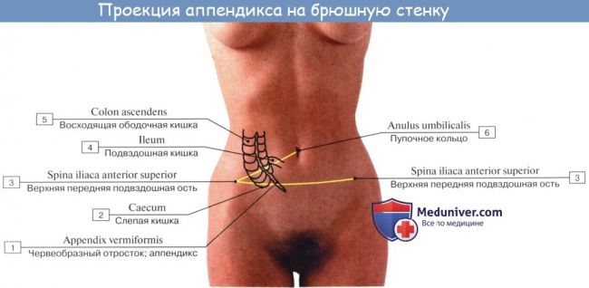 Особенности течения острого аппендицита при атипичном расположении червеобразного отростка