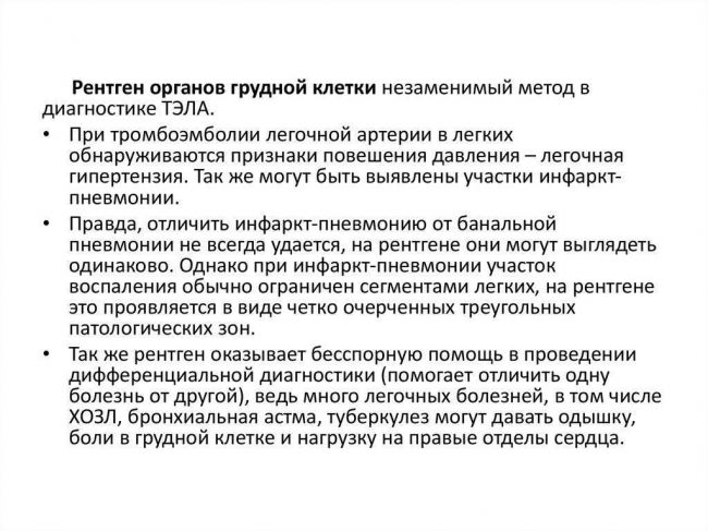 Диагностика пневмонии легких при помощи рентгена