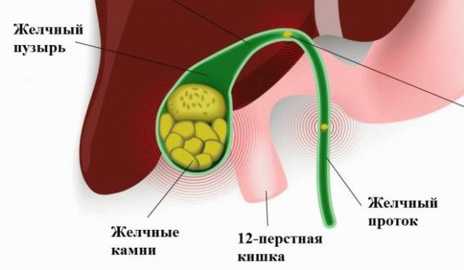 Блюда при диет. при гастрите