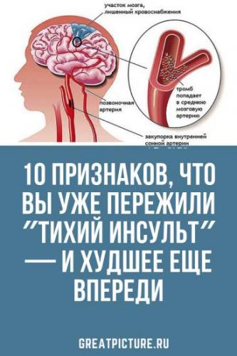 Атеросклероз сонных артерий и сосудов шеи: симптомы и лечение