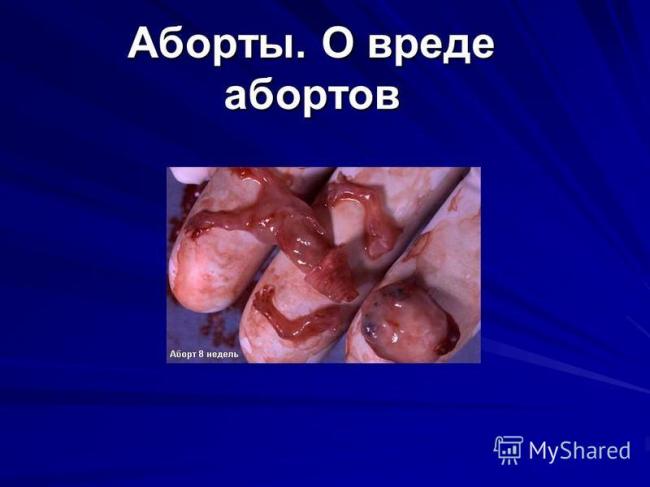 Восстановление после аборта, рекомендации для вашего организма | proaborty