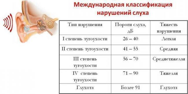 Тугоухость у ребенка: причины, симптомы, лечение тугоухости, нейросенсорная тугоухость