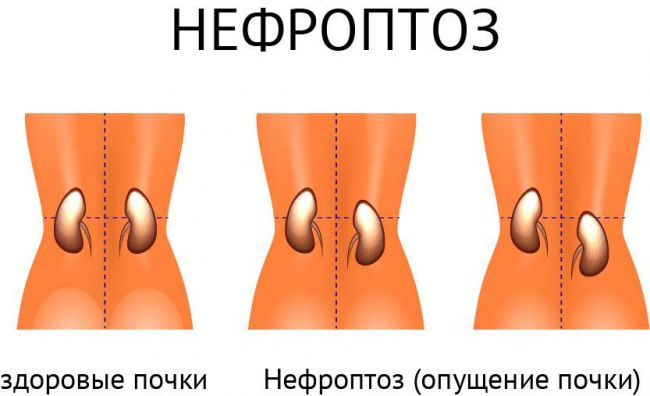 Болит справа под ребром сзади кашель