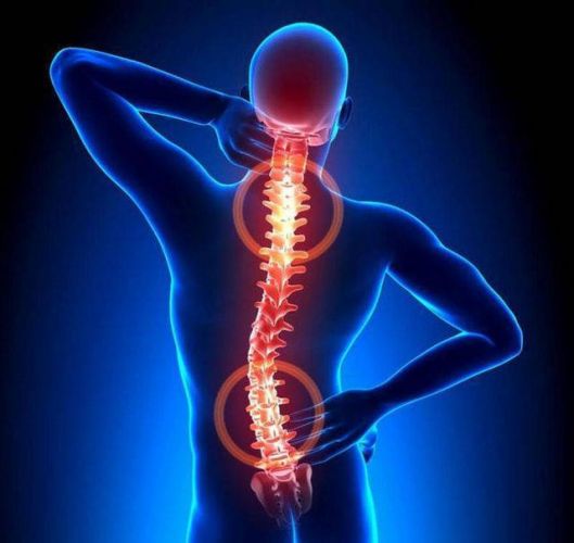 Деформация дурального мешка позвоночника что это такое и лечение