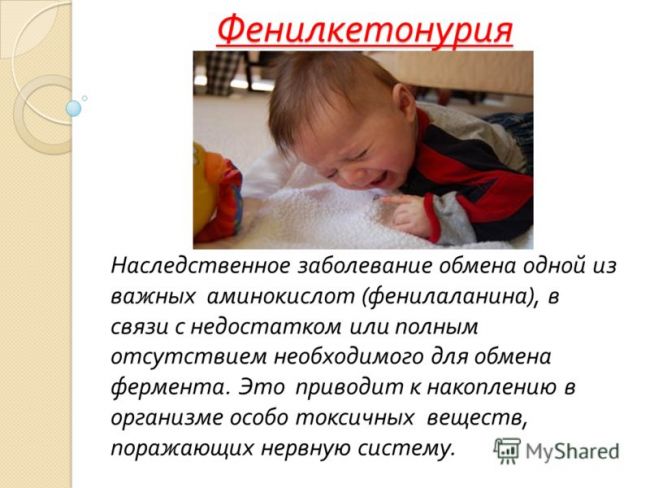 Симптомы и лечение нарушения метаболизма белка фенилаланина у детей