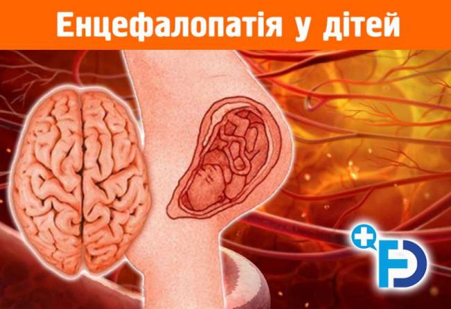 Что такое энцефалопатия и как ее выявить