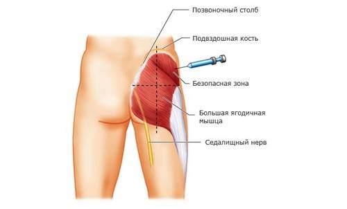 Мелоксикам уколы инструкция по применению