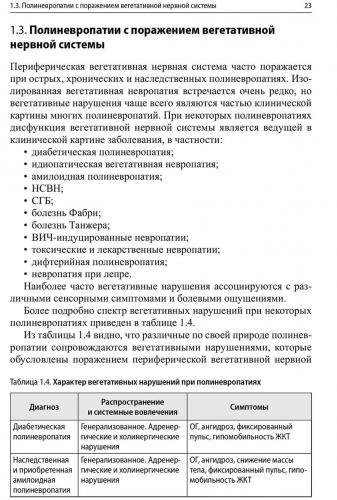 Симптомы периферической невропатии