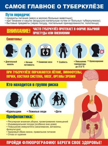 Туберкулез легких: признаки ранней стадии, симптомы и лечение у взрослых