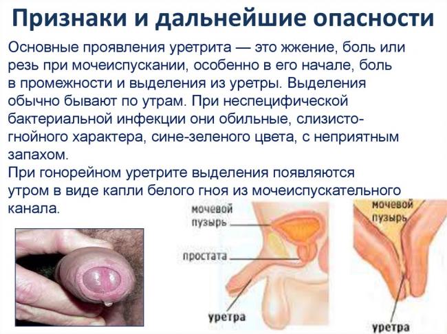 Выделения из уретры: причины и диагностика