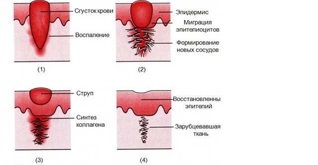 Укус насекомого отек века