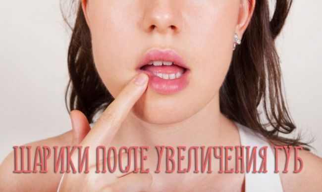 Гиалуроновая кислота для лица в инъекциях для уколов. какие препараты лучше, как применять, как действует, результаты, фото до и после, цена в аптеке