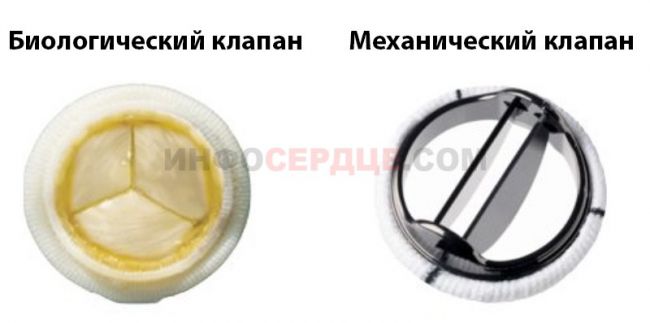 Клиническая эхокардиография