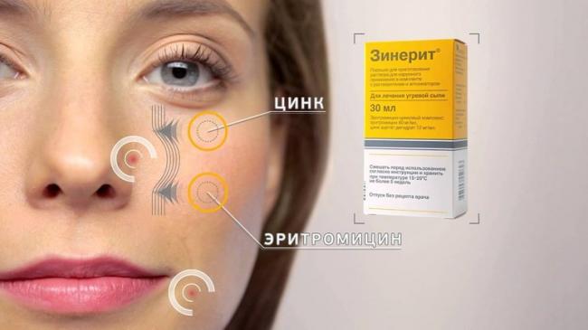 Зинерит от прыщей: инструкция по применению, обзор и отзывы