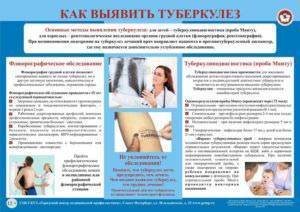 Манту после болезни