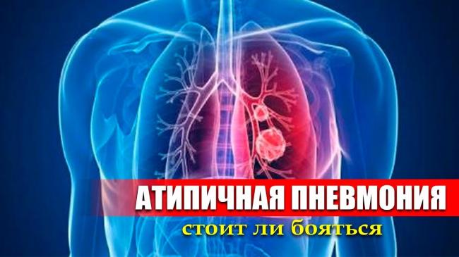 Пневмония без температуры