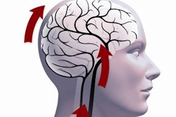 Сосудистая энцефалопатия: развитие, признаки и степени, как лечить, прогноз