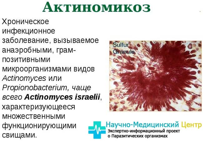 Польза и вред бактерий для человеческого организма