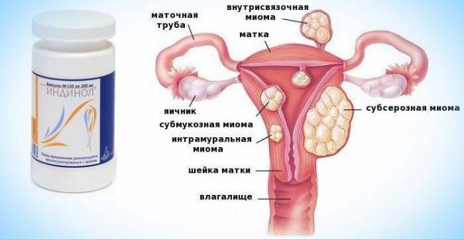 Метаболическое средство ЗАО МираксБиоФарма Индинол Форто - отзыв