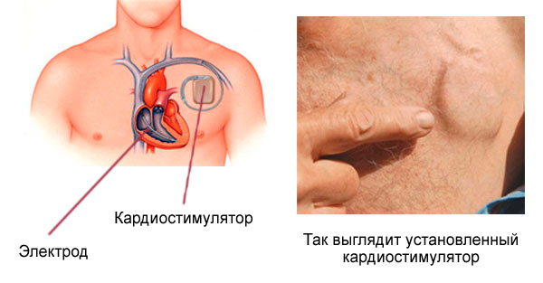 причины, признаки, симптомы и лечение
