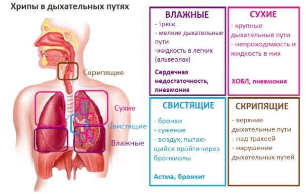 Обструктивный бронхит – симптомы, лечение