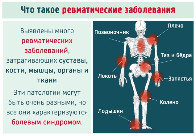 Признаки пневмонии у взрослого без температуры с кашлем сухим