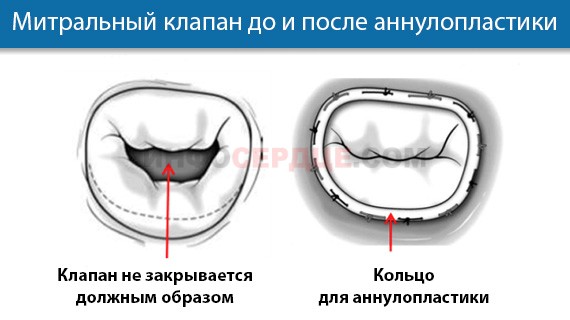 Клиническая эхокардиография