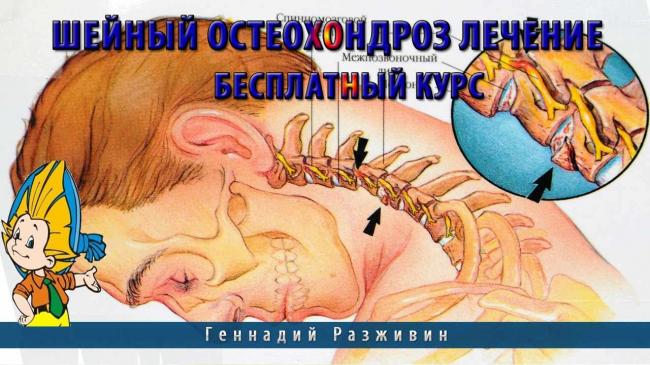 Массаж и упражнения при шейном остеохондрозе в домашних условиях: фото и видео