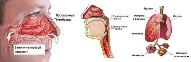 Психосоматика горло болит, першит, ком, мокрота, причины, лечение