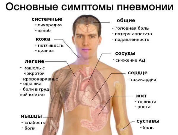 Может ли быть воспаление легких без температуры и кашля, особенности лечения
