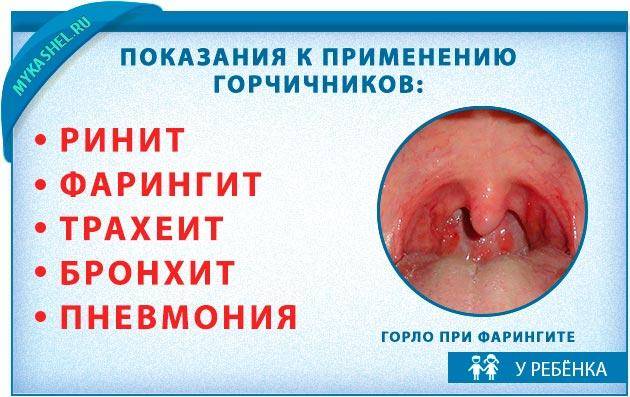 Сколько держать горчичники при кашле?