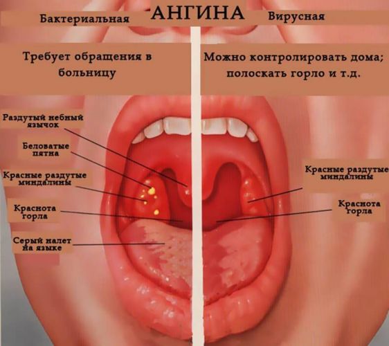 Гексорал для детей