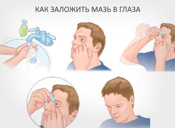 Кератит глаза народные средства