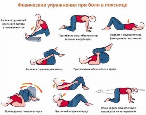 Реабилитация после удаления грыжи поясничного отдела позвоночника