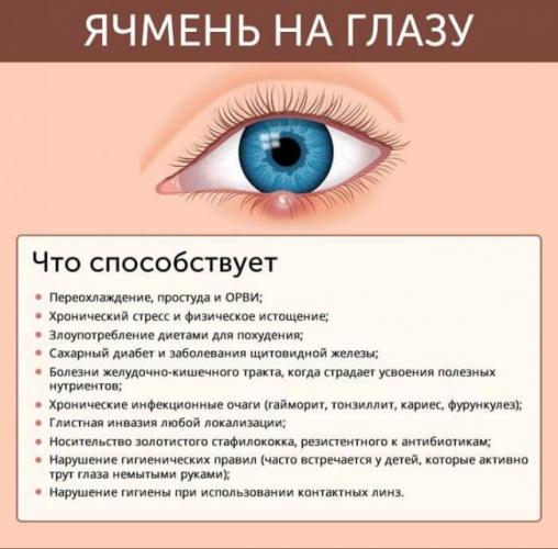 Как избавиться от ячменя на глазу: 10 простых домашних средств