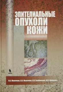 Что такое аденома, и какие виды аденомы существуют?