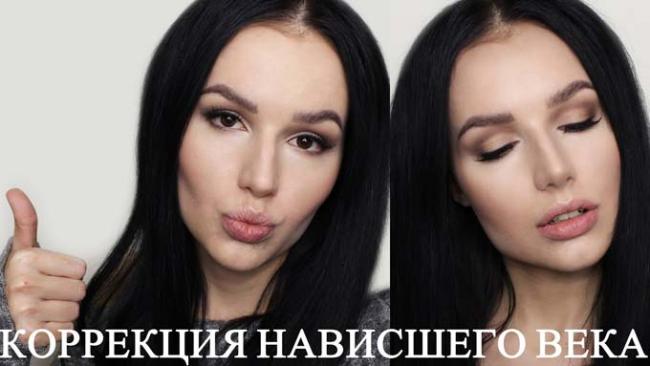 Птоз верхнего века: что нужно знать косметологу