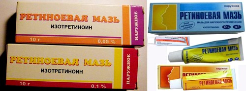 Ретиноевая мазь (retinoic ointment)